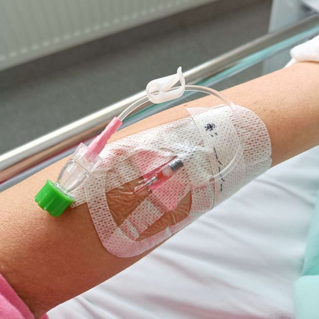 Keuhkokuume kokemus kanyyli